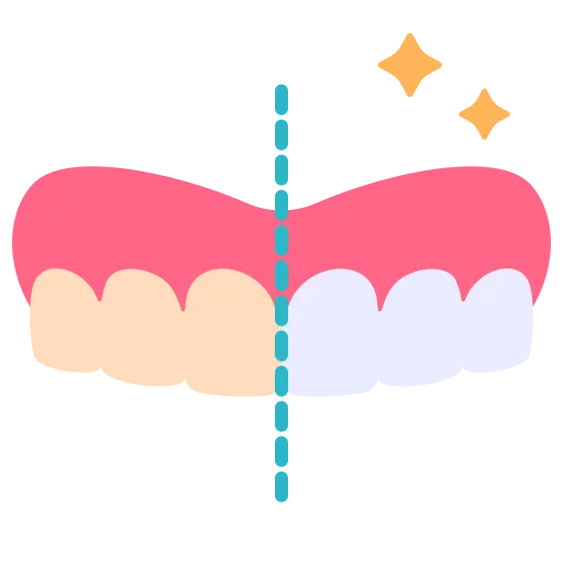 Teeth Whitening
